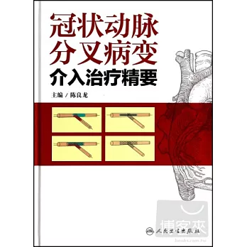 冠狀動脈分叉病變介入治療精要