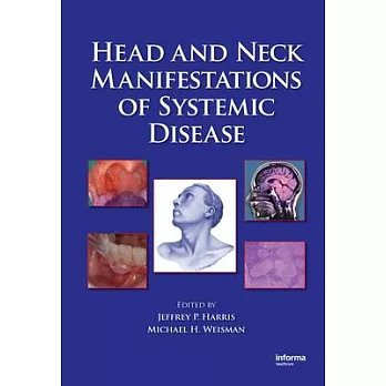 Head and Neck Manifestations of Systemic Disease