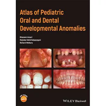 Atlas of Pediatric Oral and Dental Developmental Anomalies