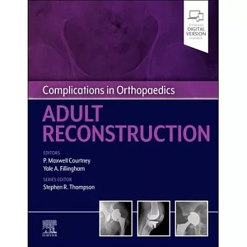 Complications in Orthopaedics: Adult Reconstruction