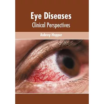 Eye Diseases: Clinical Perspectives