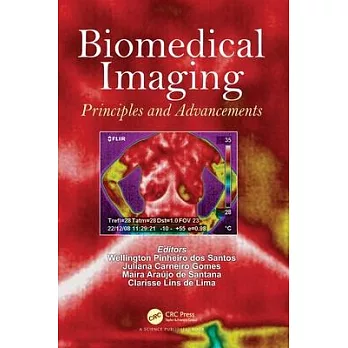 Biomedical Imaging: Principles and Advancements