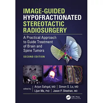 Image-Guided Hypofractionated Stereotactic Radiosurgery: A Practical Approach to Guide Treatment of Brain and Spine Tumors