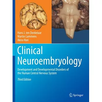 Clinical Neuroembryology: Development and Developmental Disorders of the Human Central Nervous System