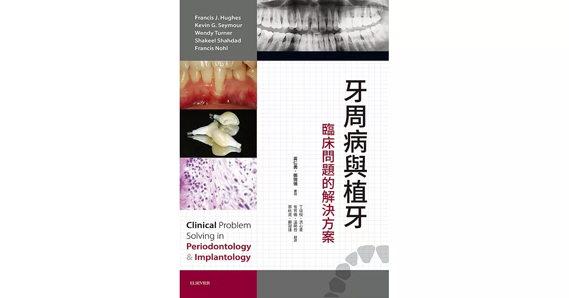 牙周病與植牙：臨床問題的解決方案 | 拾書所