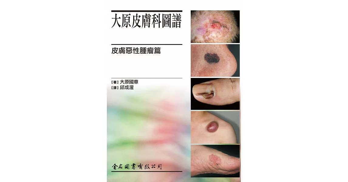 大原皮膚科圖譜 皮膚惡性腫瘤篇 | 拾書所