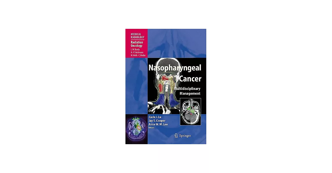 Nasopharyngeal Cancer: Multidisciplinary Management | 拾書所