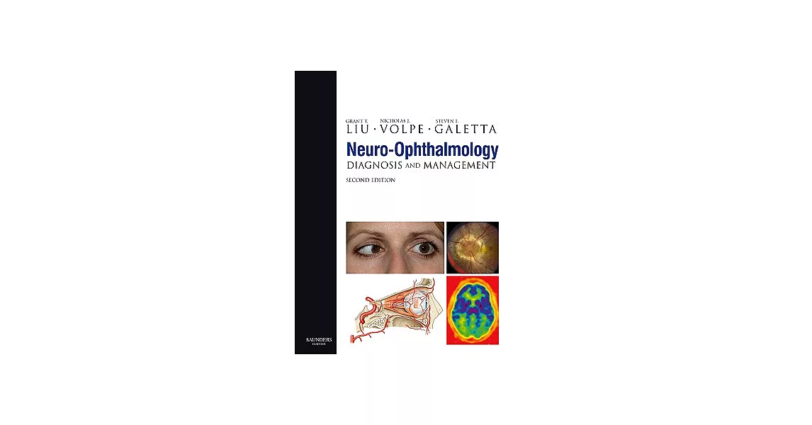 Neuro-Ophthalmology: Diagnosis and Management | 拾書所