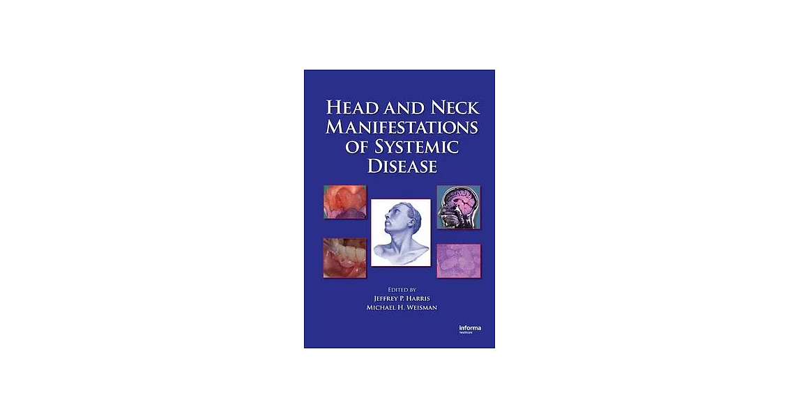 Head and Neck Manifestations of Systemic Disease | 拾書所