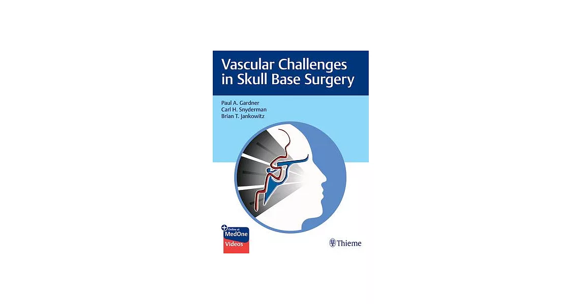 Vascular Challenges in Skull Base Surgery | 拾書所