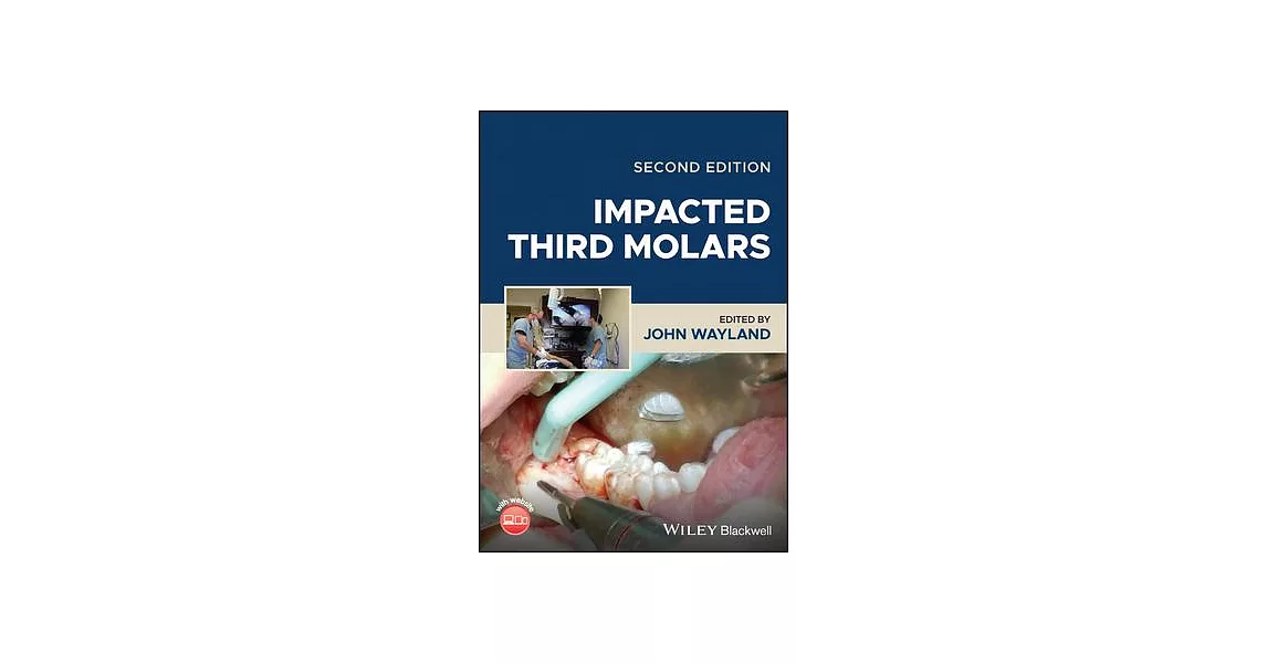 Impacted Third Molars | 拾書所