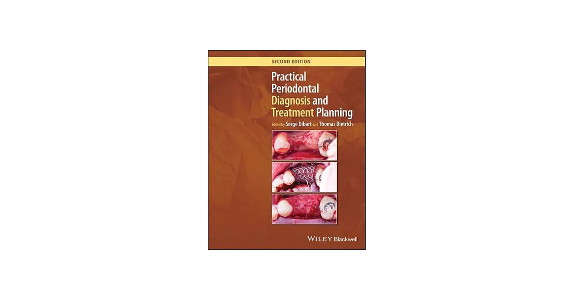 Practical Periodontal Diagnosis and Treatment Planning | 拾書所