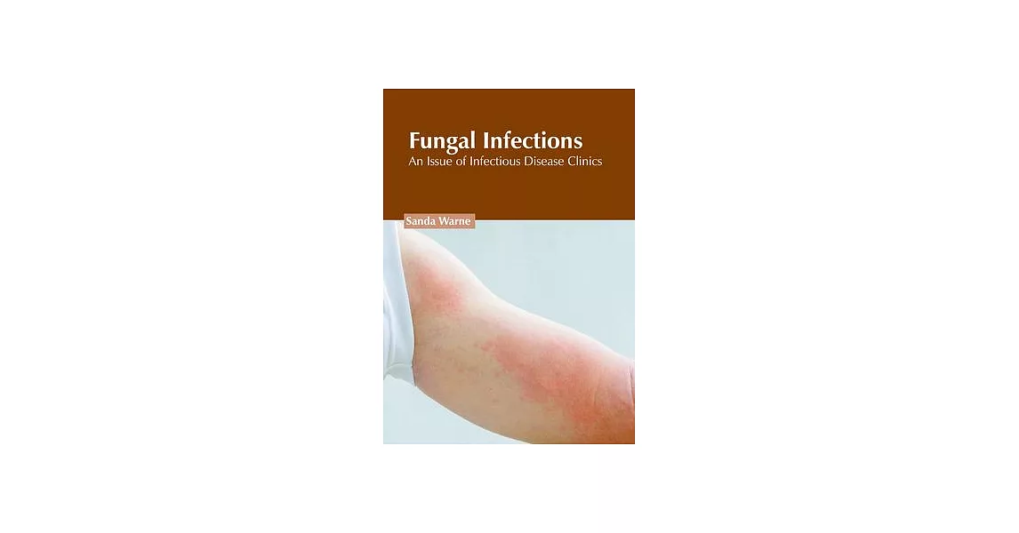 Fungal Infections: An Issue of Infectious Disease Clinics | 拾書所