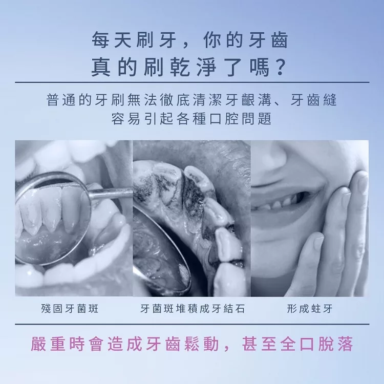 FerdY佛迪 FD-EX88 - 詳情6