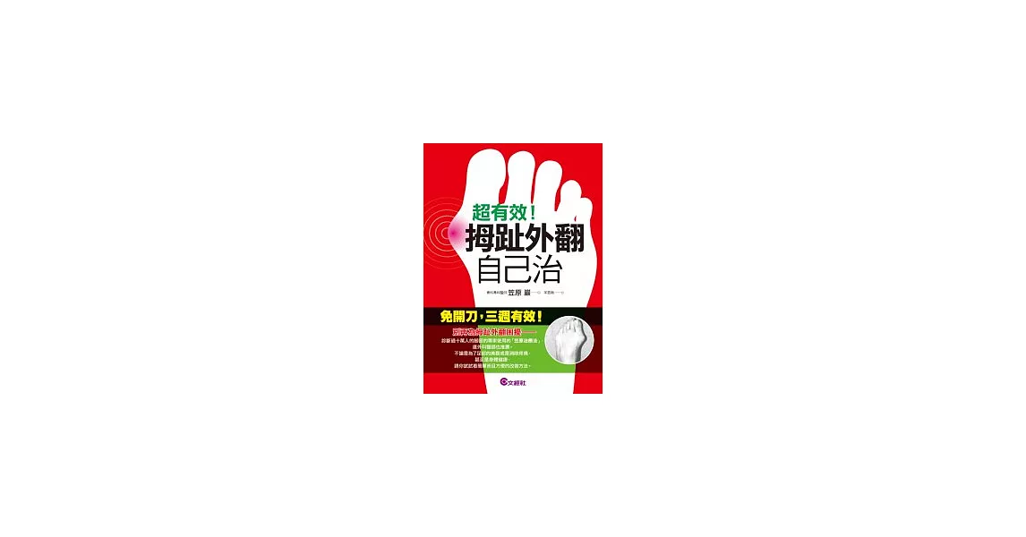 超有效!拇趾外翻自己治