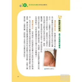 博客來 戒吃 戒抓 告別異位性皮膚炎 台大過敏免疫風濕科權威醫師 商業周刊百大良醫的經驗分享 博客來 戒吃 戒抓 告別異位性皮膚炎 台大過敏免疫風濕科權威醫師 商業周刊百大良醫的經驗分享