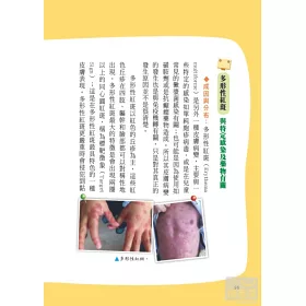 博客來 戒吃 戒抓 告別異位性皮膚炎 台大過敏免疫風濕科權威醫師 商業周刊百大良醫的經驗分享 博客來 戒吃 戒抓 告別異位性皮膚炎 台大過敏免疫風濕科權威醫師 商業周刊百大良醫的經驗分享