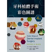 牙科植體手術彩色圖譜(4版)