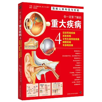 你一定要了解的重大疾病（4）：運動系統疾病·皮膚疾病·女性生殖系統疾病·眼楮疾病·耳鼻喉疾病