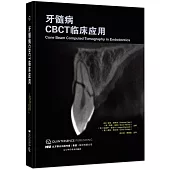 牙髓病CBCT臨床應用
