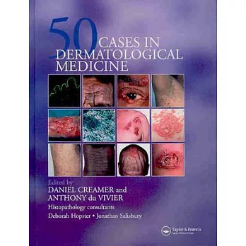 Fifty Cases in Dermatological Medicine