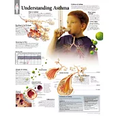 Understanding Asthma, Laminated Chart