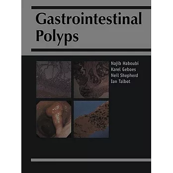 Gastrointestinal Polyps