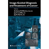 Image-Guided Diagnosis and Tratment of Cancer