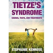Tietze’s Syndrome: Causes, Tests, and Treatments
