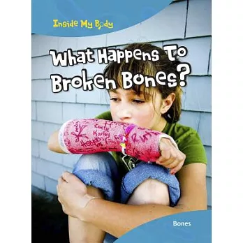 What happens to broken bones?