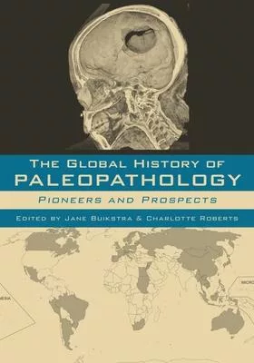 The Global History of Paleopathology: Pioneers and Prospects