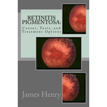 Retinitis Pigmentosa: Causes, Tests, and Treatment Options