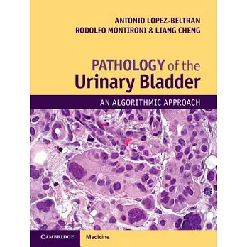 Pathology of the Urinary Bladder: An Algorithmic Approach