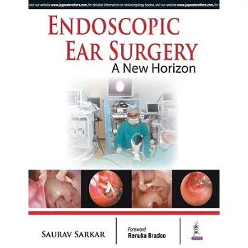 Endoscopic Ear Surgery a New Horizon
