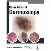 Colour Atlas of Dermoscopy