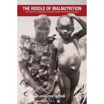 The Riddle of Malnutrition: The Long Arc of Biomedical and Public Health Interventions in Uganda