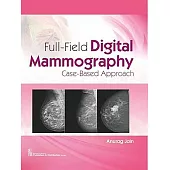 Full-Field Digital Mammography: Case-Based Approach