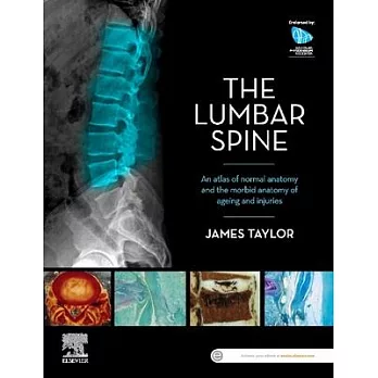 Anatomy of the Lumbar Spine: An Atlas of Normal Anatomy and the Morbid Anatomy of Ageing and Injury
