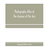 Photographic atlas of the diseases of the skin; A Series of Eighty Plates, Comprising more than One Hundred Illustrations, with Descriptive text, and