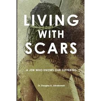 Living with Scars: A Jew Who Knows Our Suffering