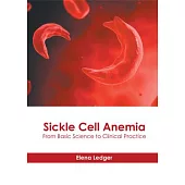 Sickle Cell Anemia: From Basic Science to Clinical Practice