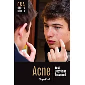 Acne: Your Questions Answered