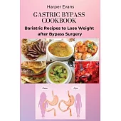 Gastric Bypass Cookbook: Bariatric Recipes to Lose Weight after Bypass Surgery