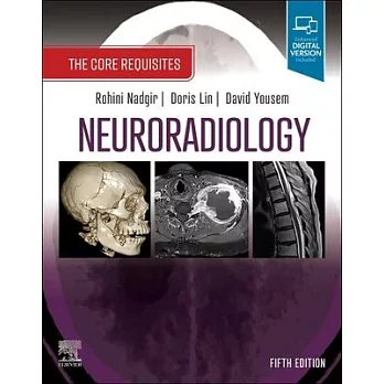 Neuroradiology: The Core Requisites