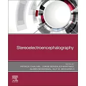Stereoelectroencephalography