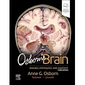 Osborn’s Brain