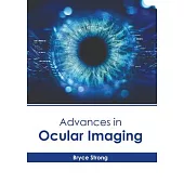 Advances in Ocular Imaging