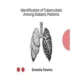 Identification of Tuberculosis Among Diabetic Patients
