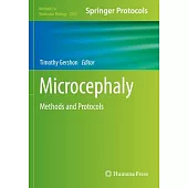 Microcephaly: Methods and Protocols