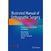 Illustrated Manual of Orthognathic Surgery: Osteotomies of the Maxilla and Midface